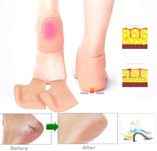 Silicone Half Heel Protector For Men & Women (Half Heel)