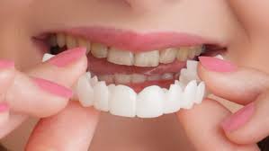 Snapon Smile/ veeners/ snap on smile veerners / veeners braces/Snapon Smile Teeth/ Snapon Smile Veeners/ Snapon Smile Artificial Teeth/ silicon braces/ Artificial teeth